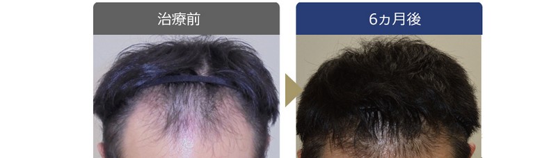 AGAIN���f�B�J���N���j�b�N���T�C�g